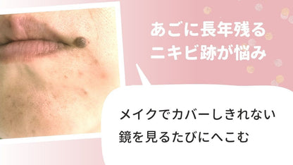 YANHEE ホワイトニングクリーム20g