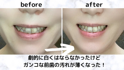 CarbonCoco ココナッツ&チャコールティースホワイトニングストリップ14枚