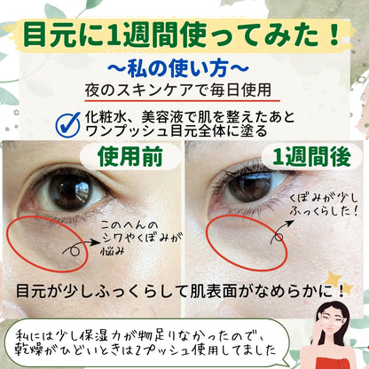 Lorealリバイタリフトフィラー・アイクリームフォーフェイス30ml