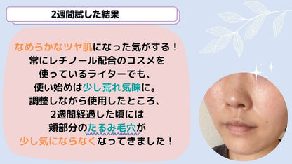 Obagi オバジ360・レチノール0.5クリーム28g