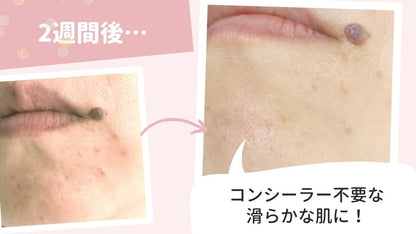 YANHEE ホワイトニングクリーム20g