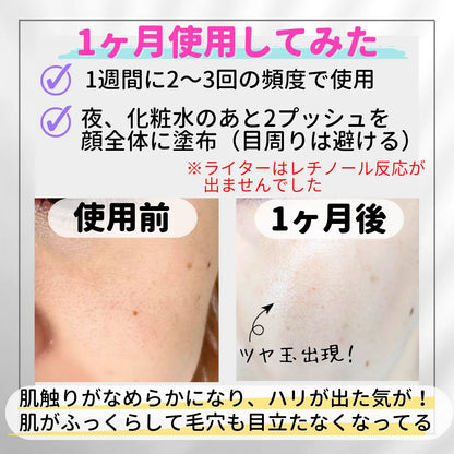 No7 ピュアレチノール 0.3% Retinol Night Concentrate Serum 30ml