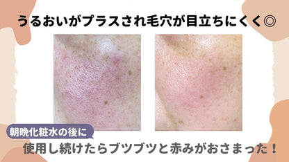 Avene シカルファットプラス・リペアクリーム40ml - styme shopping